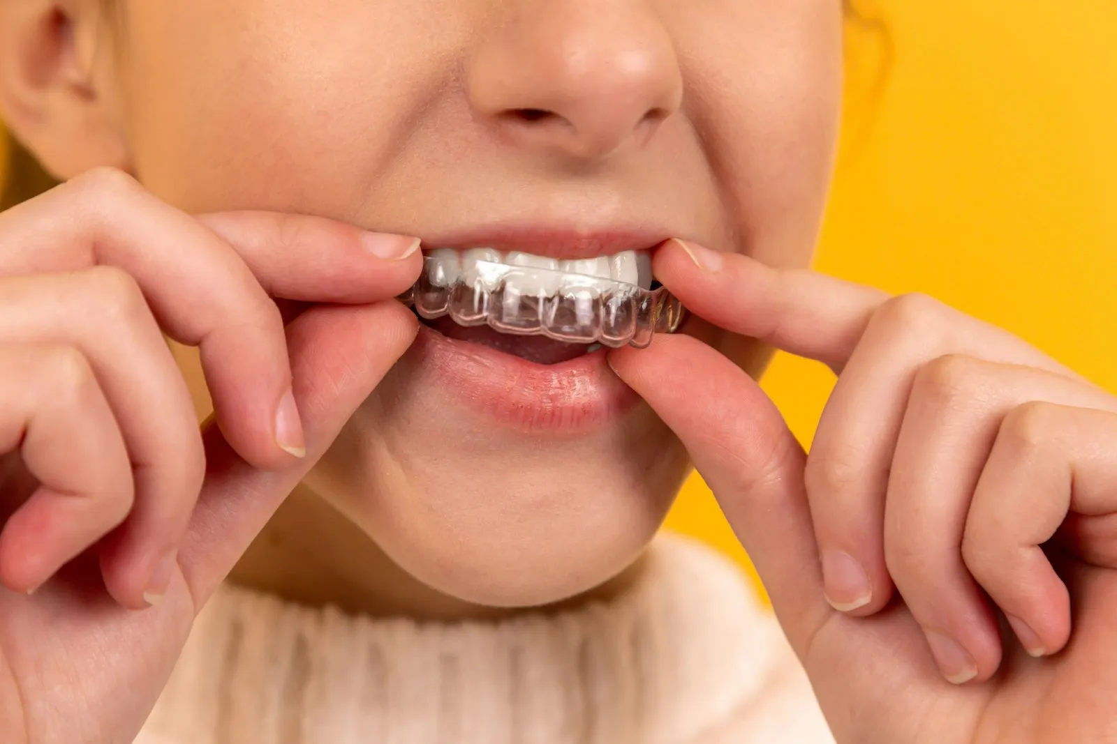 Sonrisa saludable tras tratamiento de estética dental