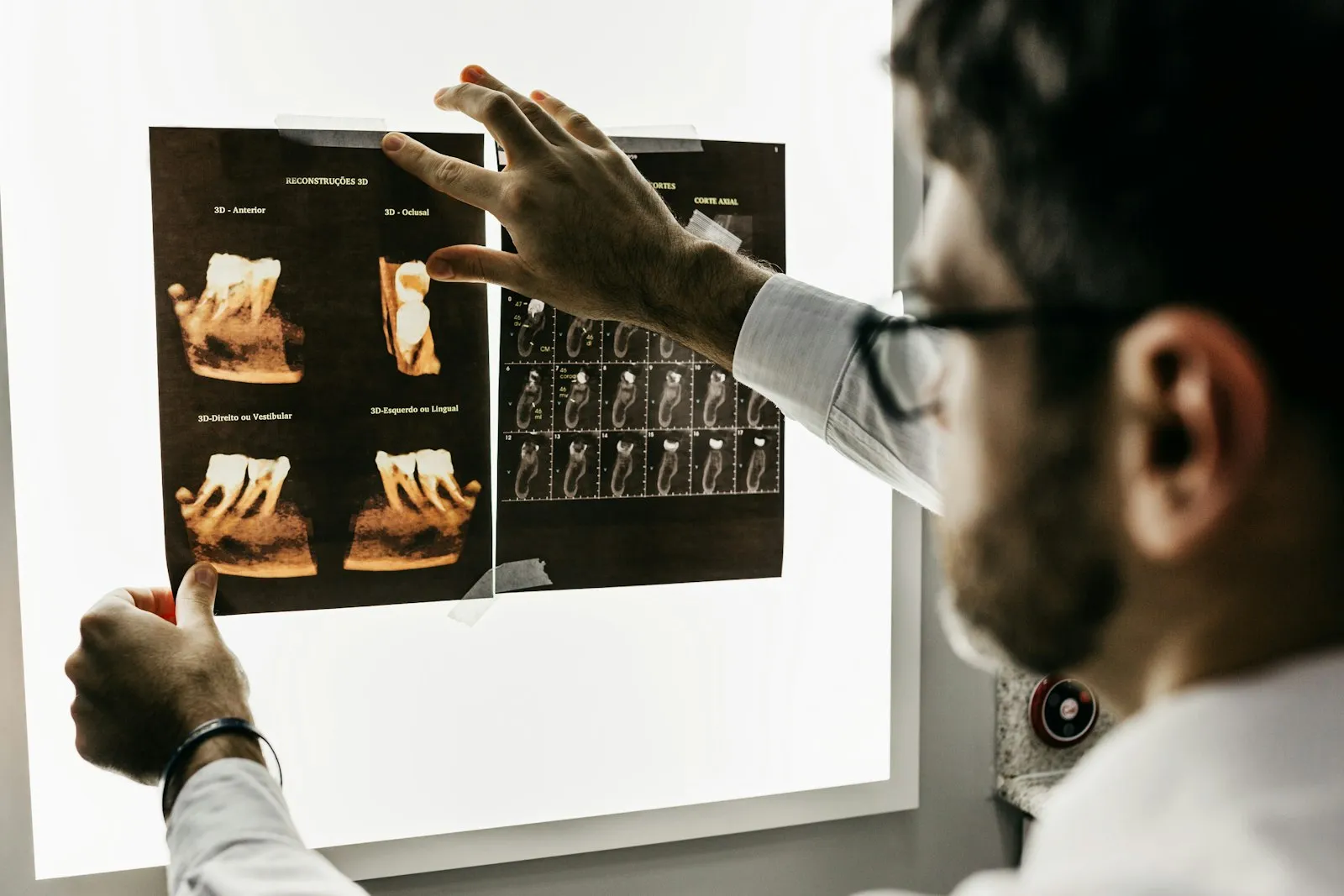 Odontólogo realizando una limpieza dental profesional